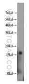 Hemoglobin Subunit Delta antibody, 16824-1-AP, Proteintech Group, Western Blot image 