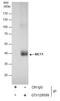 Solute Carrier Family 16 Member 1 antibody, GTX129599, GeneTex, Immunoprecipitation image 
