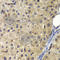 AP-2 complex subunit alpha-2 antibody, A5391, ABclonal Technology, Immunohistochemistry paraffin image 