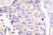 Phospholipase C Gamma 1 antibody, LS-C192194, Lifespan Biosciences, Immunohistochemistry frozen image 