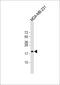 Thyroid Stimulating Hormone Subunit Beta antibody, 63-549, ProSci, Western Blot image 