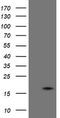 TPD52 Like 3 antibody, TA504965AM, Origene, Western Blot image 
