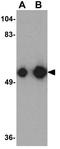 Kringle Containing Transmembrane Protein 1 antibody, GTX31876, GeneTex, Western Blot image 