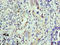 Karyopherin Subunit Alpha 1 antibody, LS-C317567, Lifespan Biosciences, Immunohistochemistry paraffin image 