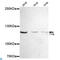 ADAP antibody, LS-C812975, Lifespan Biosciences, Western Blot image 