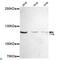 FYN Binding Protein 1 antibody, LS-C812975, Lifespan Biosciences, Western Blot image 