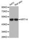 Keratin 14 antibody, abx002877, Abbexa, Western Blot image 