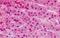 Zinc Finger And BTB Domain Containing 16 antibody, MBS249083, MyBioSource, Immunohistochemistry paraffin image 