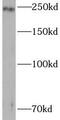 Tight Junction Protein 1 antibody, FNab09750, FineTest, Western Blot image 