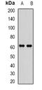 Epoxide Hydrolase 2 antibody, orb340791, Biorbyt, Western Blot image 