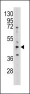 Adenosylhomocysteinase antibody, LS-C98602, Lifespan Biosciences, Western Blot image 