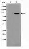 AP2 Associated Kinase 1 antibody, TA347740, Origene, Western Blot image 