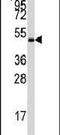 Protein Kinase AMP-Activated Non-Catalytic Subunit Gamma 1 antibody, PA5-13795, Invitrogen Antibodies, Western Blot image 