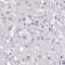 Ankyrin Repeat Domain 45 antibody, PA5-56809, Invitrogen Antibodies, Immunohistochemistry frozen image 