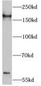 Ras GTPase-activating-like protein IQGAP2 antibody, FNab04379, FineTest, Western Blot image 