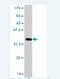 ALK Receptor Tyrosine Kinase antibody, H00000238-M02, Novus Biologicals, Western Blot image 