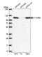 Spindlin Interactor And Repressor Of Chromatin Binding antibody, NBP2-58309, Novus Biologicals, Western Blot image 