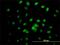 Interferon Related Developmental Regulator 2 antibody, H00007866-M01, Novus Biologicals, Immunofluorescence image 