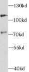 PHF-tau antibody, FNab08505, FineTest, Western Blot image 