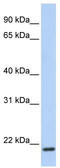 Transmembrane Protein 35A antibody, TA338472, Origene, Western Blot image 