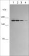 Integrin Subunit Alpha L antibody, IM5941, ECM Biosciences, Western Blot image 