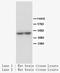 Tryptophan Hydroxylase 1 antibody, LS-C171008, Lifespan Biosciences, Western Blot image 