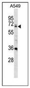 DEAD-Box Helicase 28 antibody, AP51220PU-N, Origene, Western Blot image 