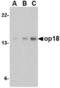 Stathmin 1 antibody, TA306434, Origene, Western Blot image 