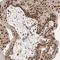 GATA Zinc Finger Domain Containing 2A antibody, NBP1-87360, Novus Biologicals, Immunohistochemistry frozen image 