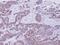 Eukaryotic Translation Initiation Factor 1A Y-Linked antibody, GTX118482, GeneTex, Immunohistochemistry paraffin image 