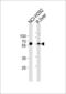 Methylcrotonoyl-CoA Carboxylase 2 antibody, MBS9214337, MyBioSource, Western Blot image 