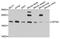 Centrin 3 antibody, A8111, ABclonal Technology, Western Blot image 