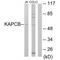 cAMP-dependent protein kinase catalytic subunit beta antibody, A05366, Boster Biological Technology, Western Blot image 
