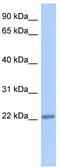 Trafficking Protein Particle Complex 5 antibody, TA337766, Origene, Western Blot image 