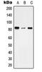 Transmembrane Channel Like 7 antibody, MBS821690, MyBioSource, Western Blot image 