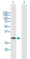 LRAT Domain Containing 2 antibody, H00286053-B01P, Novus Biologicals, Western Blot image 