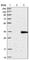 Pantothenate Kinase 2 antibody, HPA008440, Atlas Antibodies, Western Blot image 