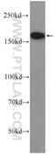 DNA Topoisomerase II Alpha antibody, 24641-1-AP, Proteintech Group, Western Blot image 