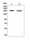 Mannose Receptor C-Type 1 antibody, A02285-2, Boster Biological Technology, Western Blot image 