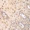 Proteasome Subunit Alpha 2 antibody, LS-C748579, Lifespan Biosciences, Immunohistochemistry paraffin image 