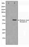 Retinoic Acid Receptor Beta antibody, TA347467, Origene, Western Blot image 