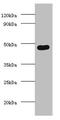 Delta Like Non-Canonical Notch Ligand 1 antibody, A54519-100, Epigentek, Western Blot image 