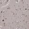 Kelch Domain Containing 3 antibody, NBP1-85197, Novus Biologicals, Immunohistochemistry paraffin image 