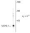 Ubiquitin C-Terminal Hydrolase L1 antibody, 50-148, ProSci, Western Blot image 