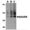 Single Ig And TIR Domain Containing antibody, MBS150698, MyBioSource, Western Blot image 