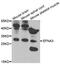 Ephrin A3 antibody, abx005870, Abbexa, Western Blot image 