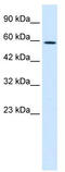 T-Box 4 antibody, TA334246, Origene, Western Blot image 