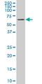 Receptor Interacting Serine/Threonine Kinase 2 antibody, LS-C133570, Lifespan Biosciences, Western Blot image 