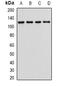 Catenin Alpha 1 antibody, abx225130, Abbexa, Western Blot image 