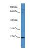 Mitogen-Activated Protein Kinase Kinase Kinase 15 antibody, NBP1-52971, Novus Biologicals, Western Blot image 